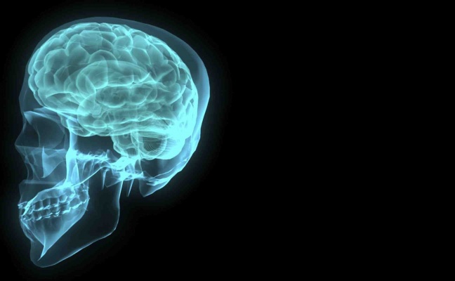 Cientistas identificam e tratam área do cérebro responsável por &#039;vozes&#039; de esquizofrênicos